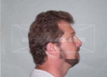 Duane A Klein