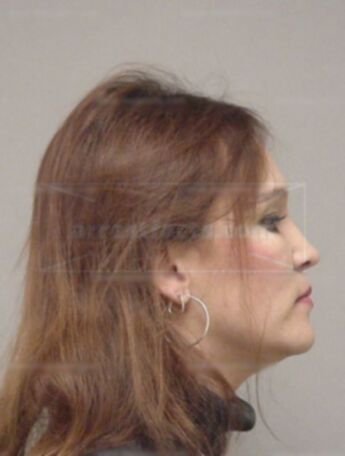 Paula A Bartz