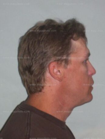 Jeffrey W Koch