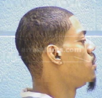 Anthony D. Hearns