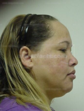 Candida Cuevas-Ruiz