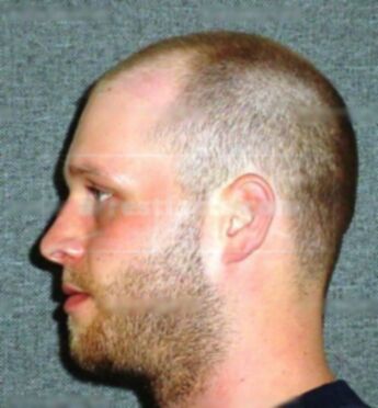 Travis L Miller