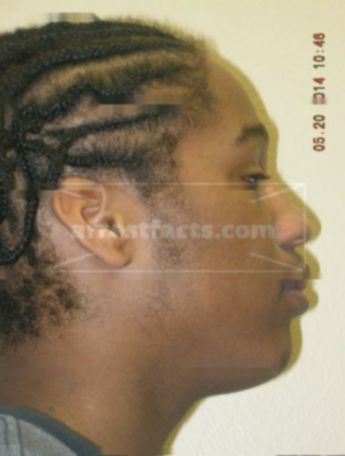 Karon H Robertson