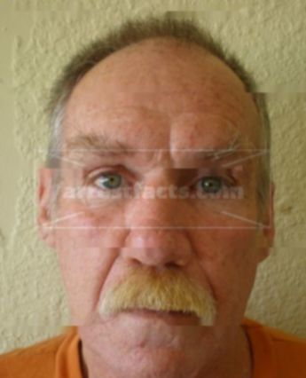 Patrick L Orr