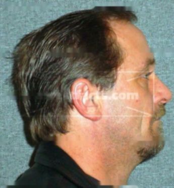 Raymond T Brown