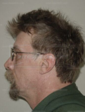 Gregory L Vanthoff