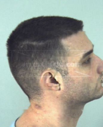 Gregory Lee Lackey