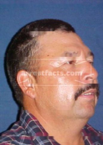 Martin Morado