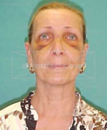 Traci A Jameson