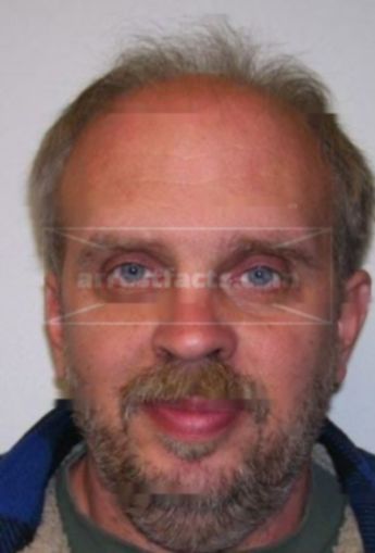 Donald L Schultz