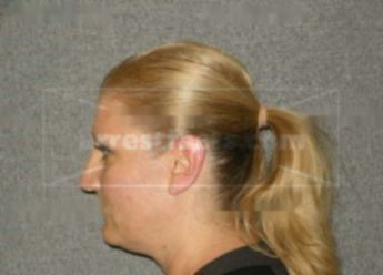 Linette M Diener