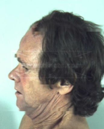 Arthur Franklin Phillips Ii