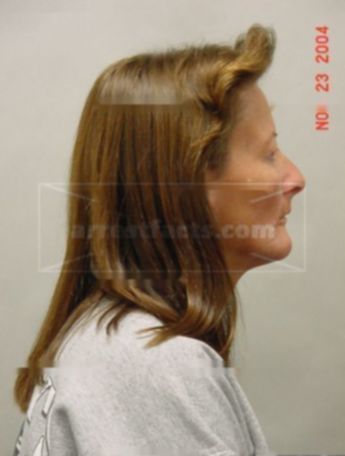 Linda S Froehlich