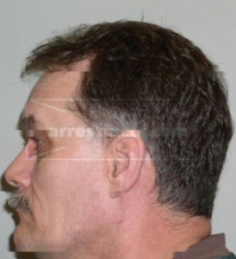Lawrence S Tuttle
