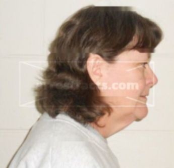 Brenda L Gammeter