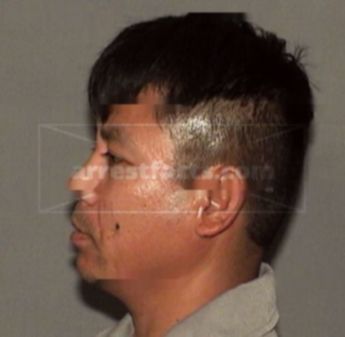 Oang Tony Voravong