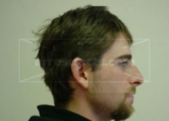 Ryan L Schuppler