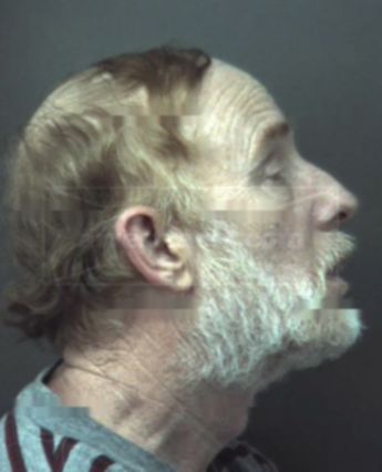 Lawrence M Lundstrom