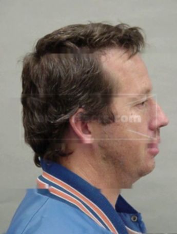 Craig B Bertrang