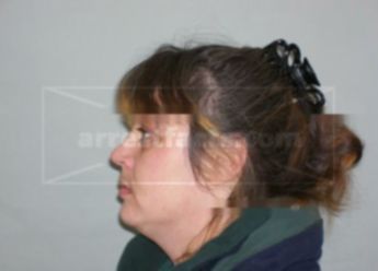Teresa M Karlinsky
