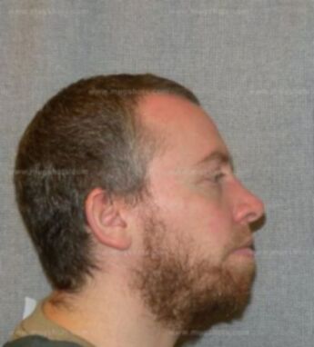 Christopher A Gilman