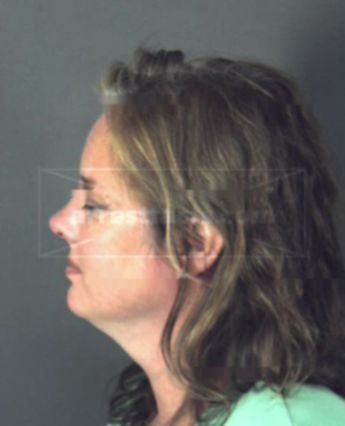 Deidre Happ Snyder