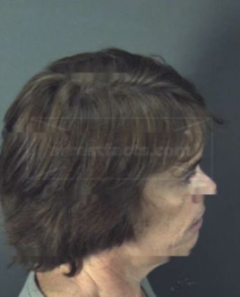 Barbara G Hill