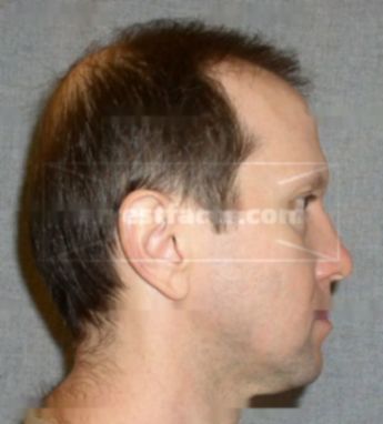 Christopher Korszen