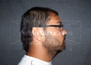 Jose Angel Rodriguez Trevino
