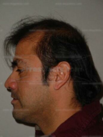 Joaquin Benavides