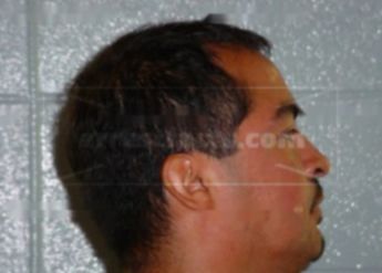 Miguel Corona