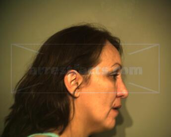 Yadira I. Millan