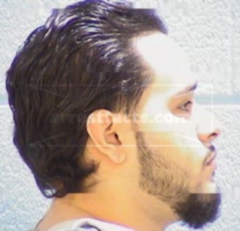 Francisco Lechuga