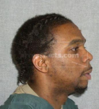 Matthew P Guyton