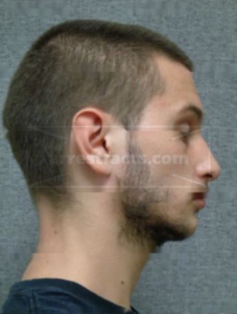 Zachary T Wohlrab