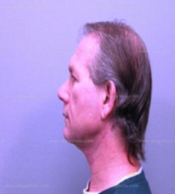 Timothy J Doty
