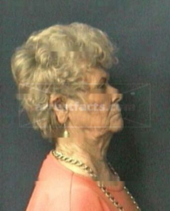 Joan L Nash