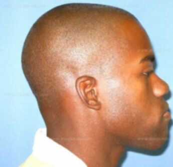 Travon D. Rice