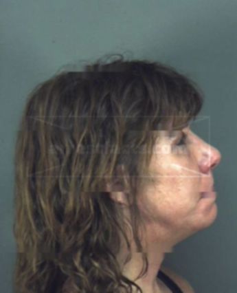 Kathi Lynn Iovine