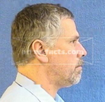 Herman L. Nitz