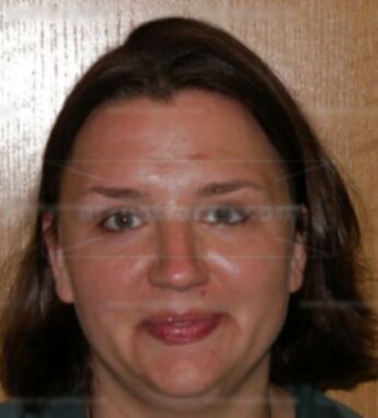 Amy J Bearwald