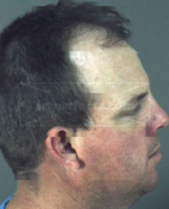 Anthony Mark Bass