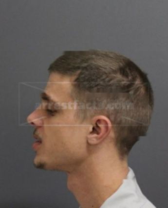Anthony Thomas Malm