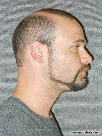 Matthew S Fritz
