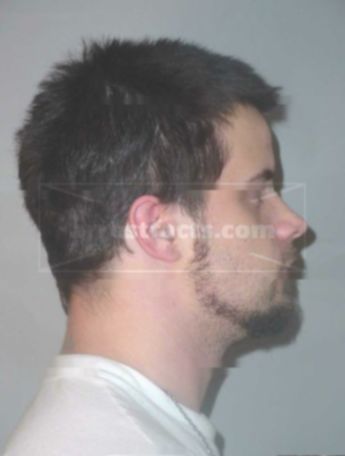 Matthew R Landwehr