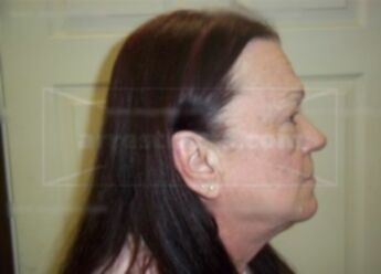 Theresa L Shropshire