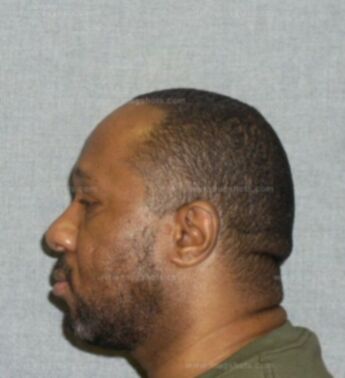 Tyrone Ferguson