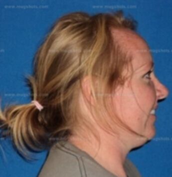 Elizabeth A Zunk