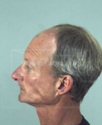 Larry Matthew White