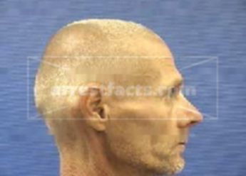 James Anthony Mitchell